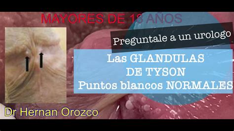 que son las glandulas tyson|Tyson Glands: What They Are, Causes & How to Get。